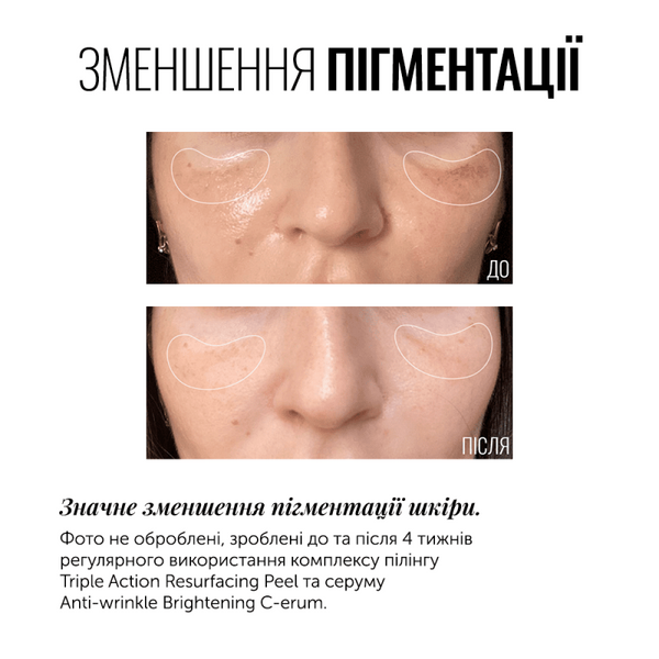 Суперконцентрований серум з вітаміном С Instytutum Anti-wrinkle brightening C-erum 30 мл id_2415 фото